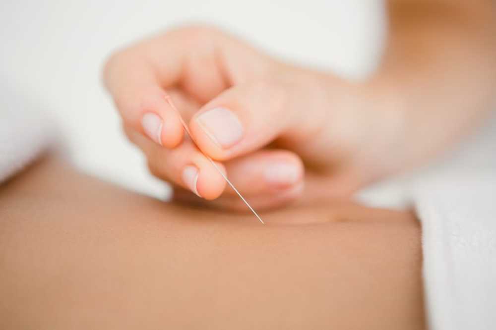 Acupuncture therapy can treat colic in babies successfully / Health News