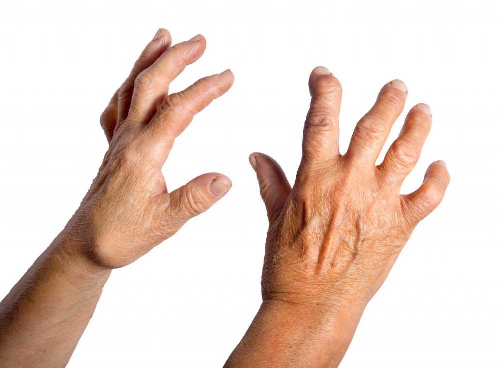 Workers in certain professions with significantly higher risk of rheumatoid arthritis / Health News