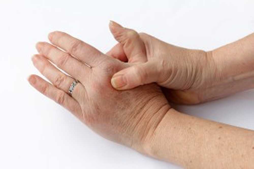 Osteoarthritis danger? Why our finger joints sometimes crack / Health News