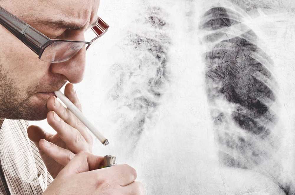 Even with chain smokers, lung cancer can be an occupational disease / Health News