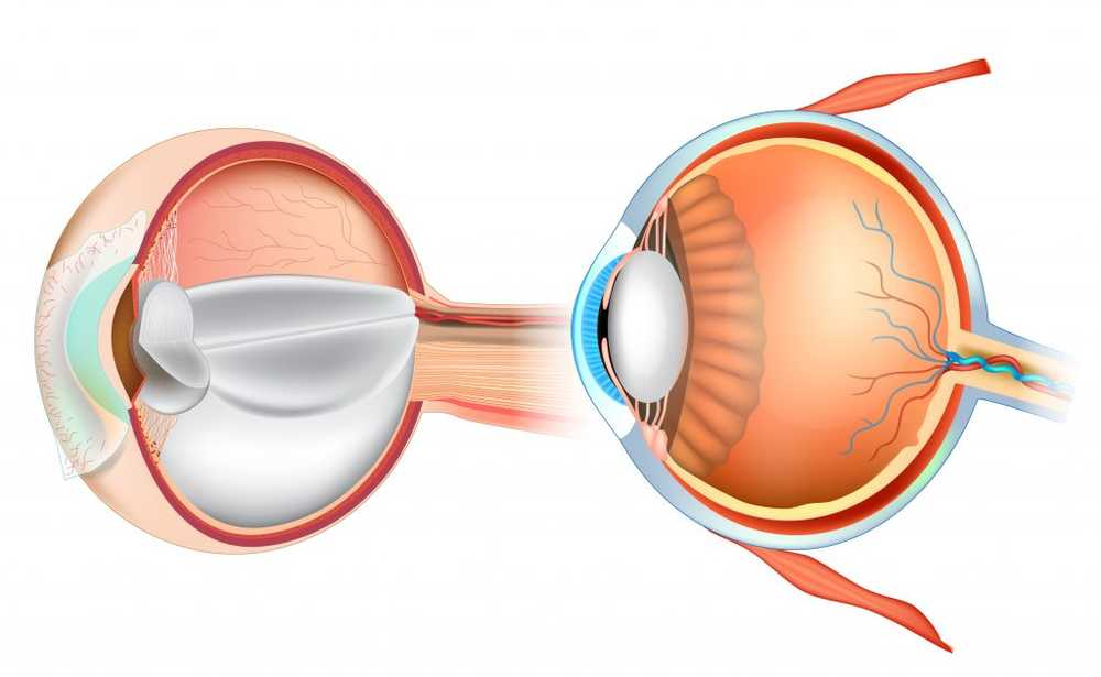 Intraocular pressure - normal values, symptoms and causes