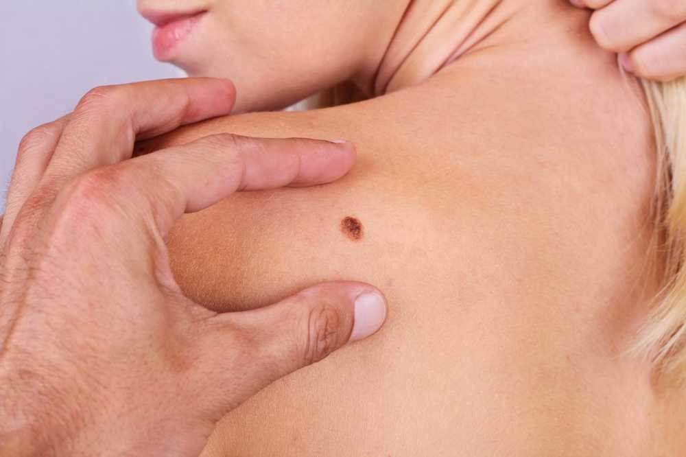 Survival Increase Signs of Skin Cancer with Mobile App Detect it yourself / Health News