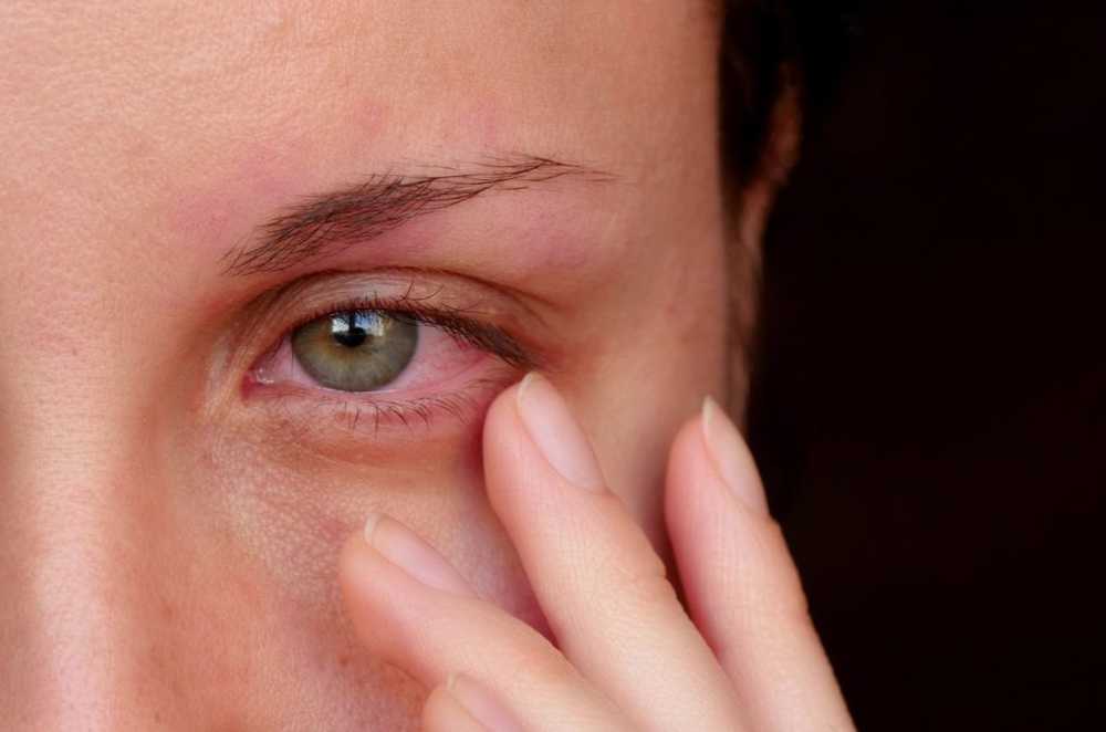 Conjunctivitis (conjunctivitis) / Diseases