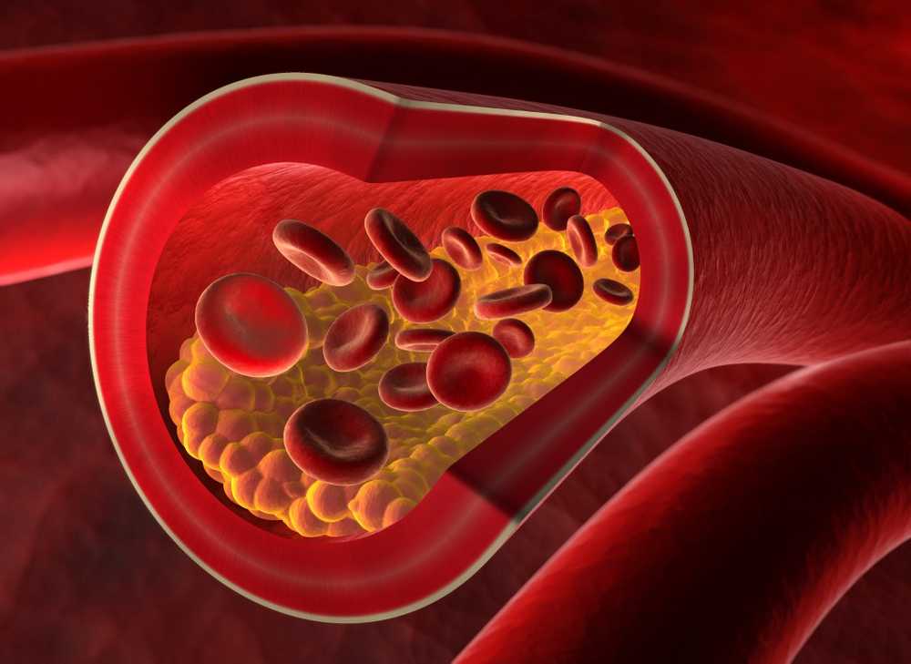 Ritmo biológico La calcificación arterial está influenciada por nuestro reloj interno / Noticias de salud