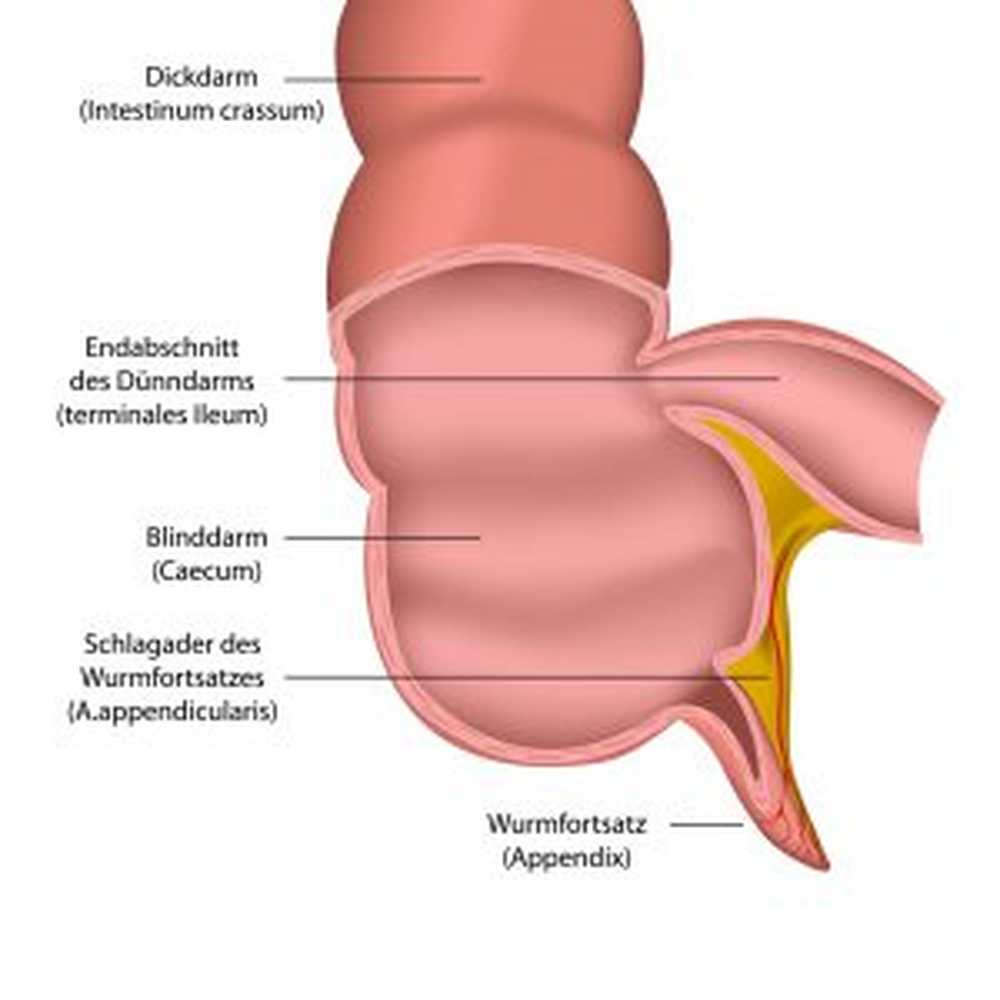 Blindedarmontsteking? Als u twijfelt, geeft u de voorkeur aan een operatie / Gezondheid nieuws