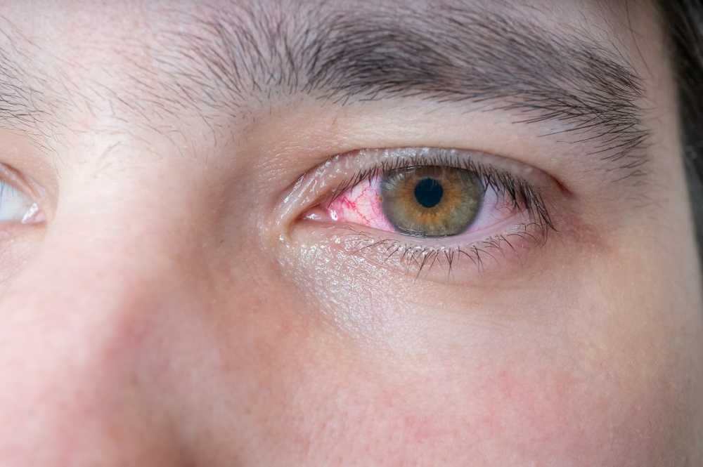 Bloed in het oog - oorzaken, symptomen en therapie / symptomen