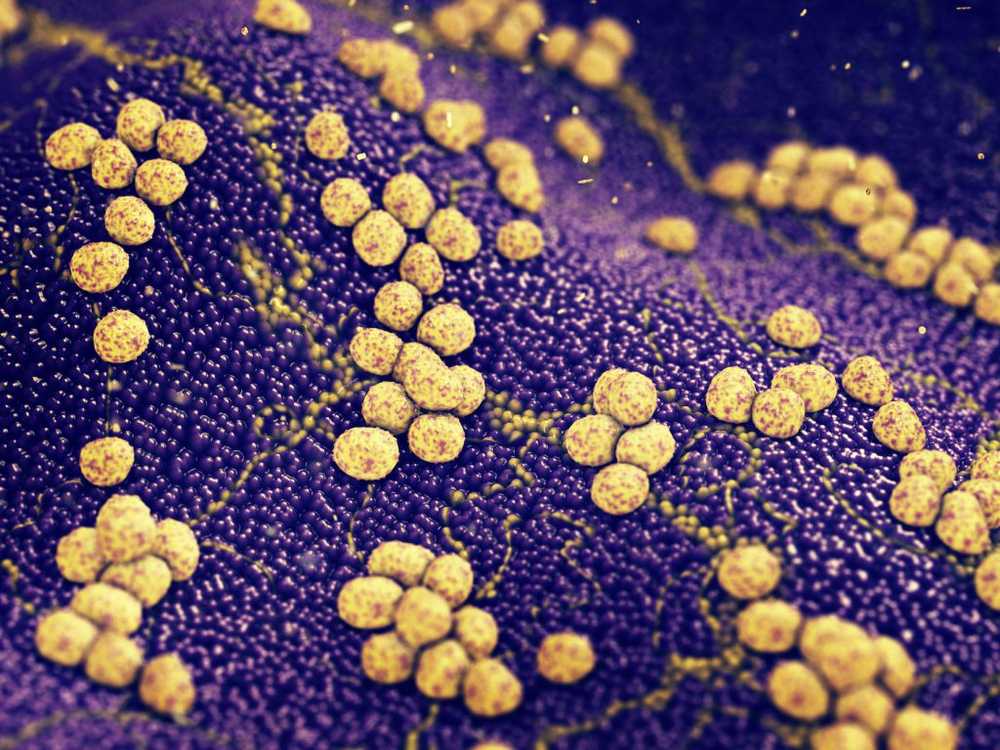 Campylobacter-bacteriën ontkiemen in kippenvlees en melk / Gezondheid nieuws