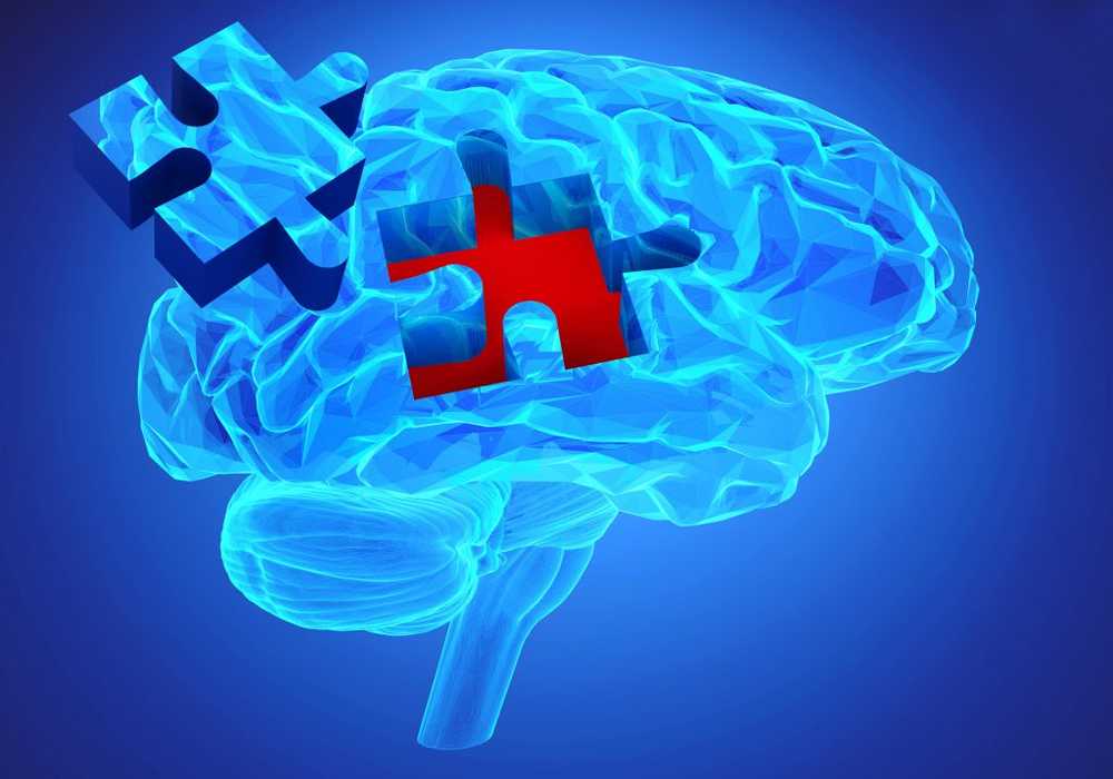 Dementia Electrical stimulation of the brain can save memory / Health News