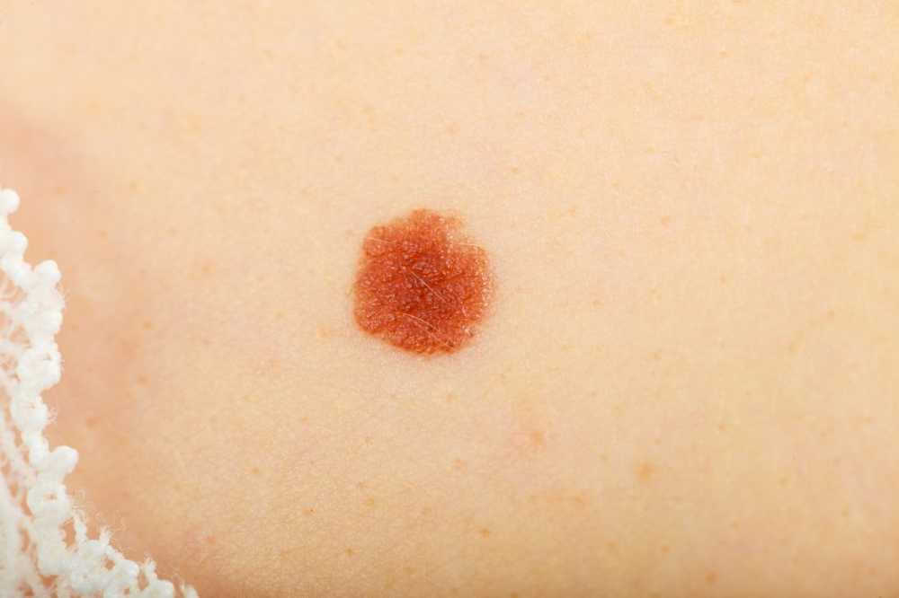 Diagnosis This liver spot acts as an early warning signal for cancer / Health News