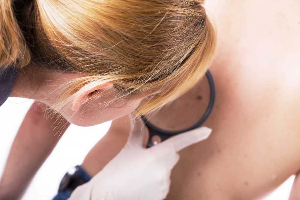 Diagnostics KI detects skin cancer as reliably as physicians / Health News