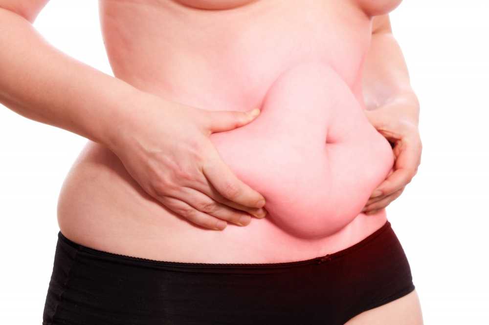 Fat lifebuoy What to do if belly fat does not want to disappear / Health News