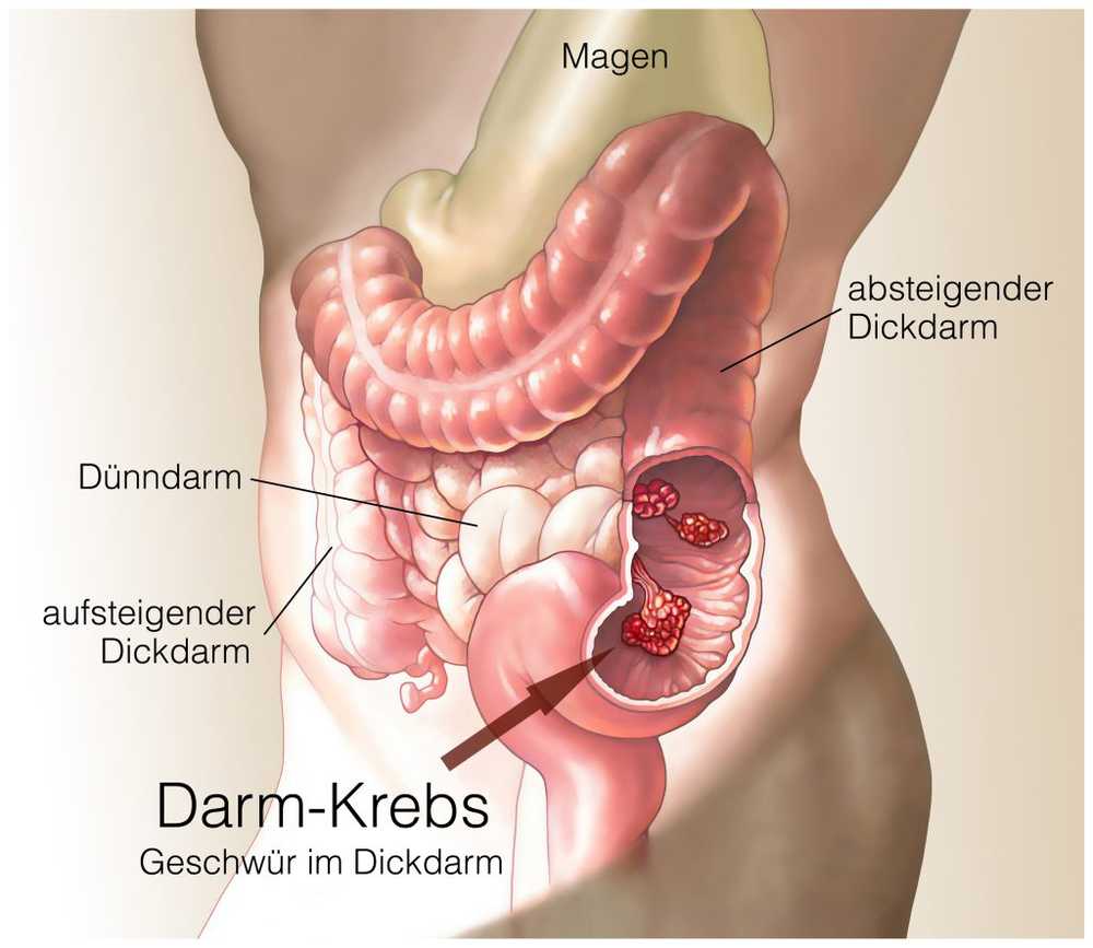 Te lange televisie verhoogt ons risico op colorectale kanker aanzienlijk / Gezondheid nieuws