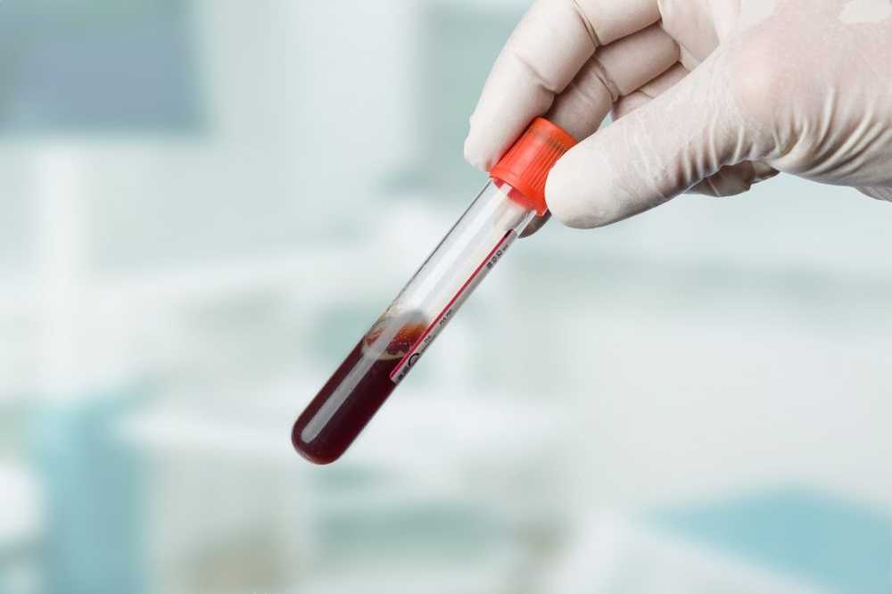 Easy and fast diagnosis through new blood test / Health News