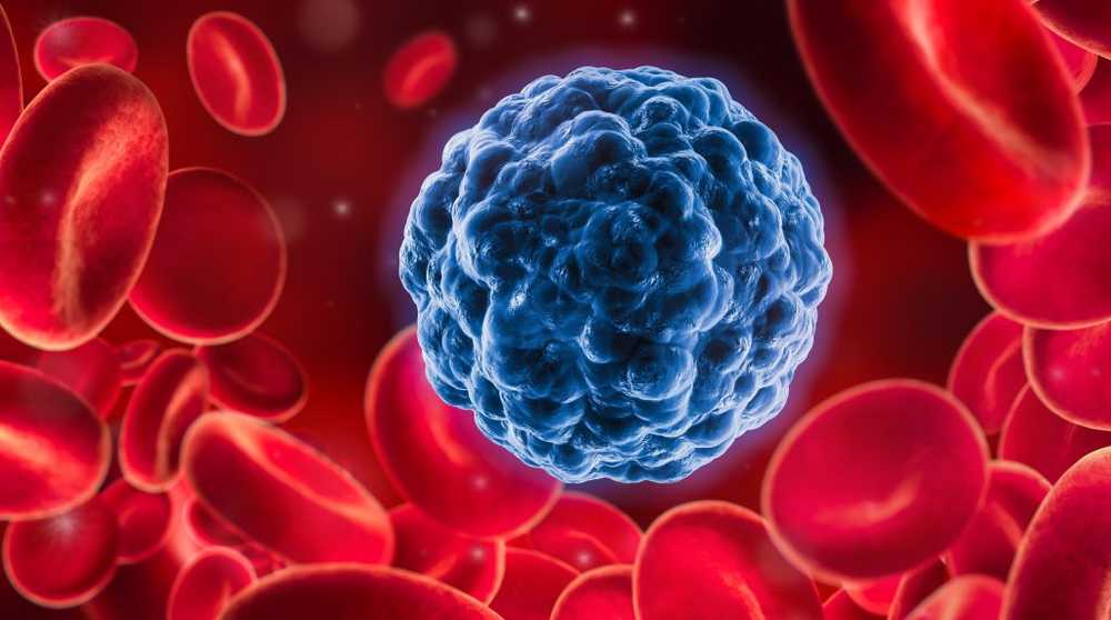 Some fatalities after new immunotherapy against cancer / Health News