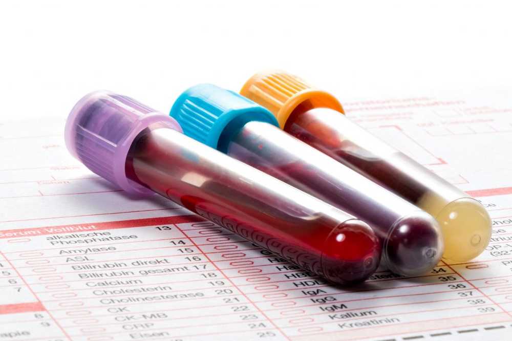 Success of immunotherapy against cancer by blood test predictable / Health News