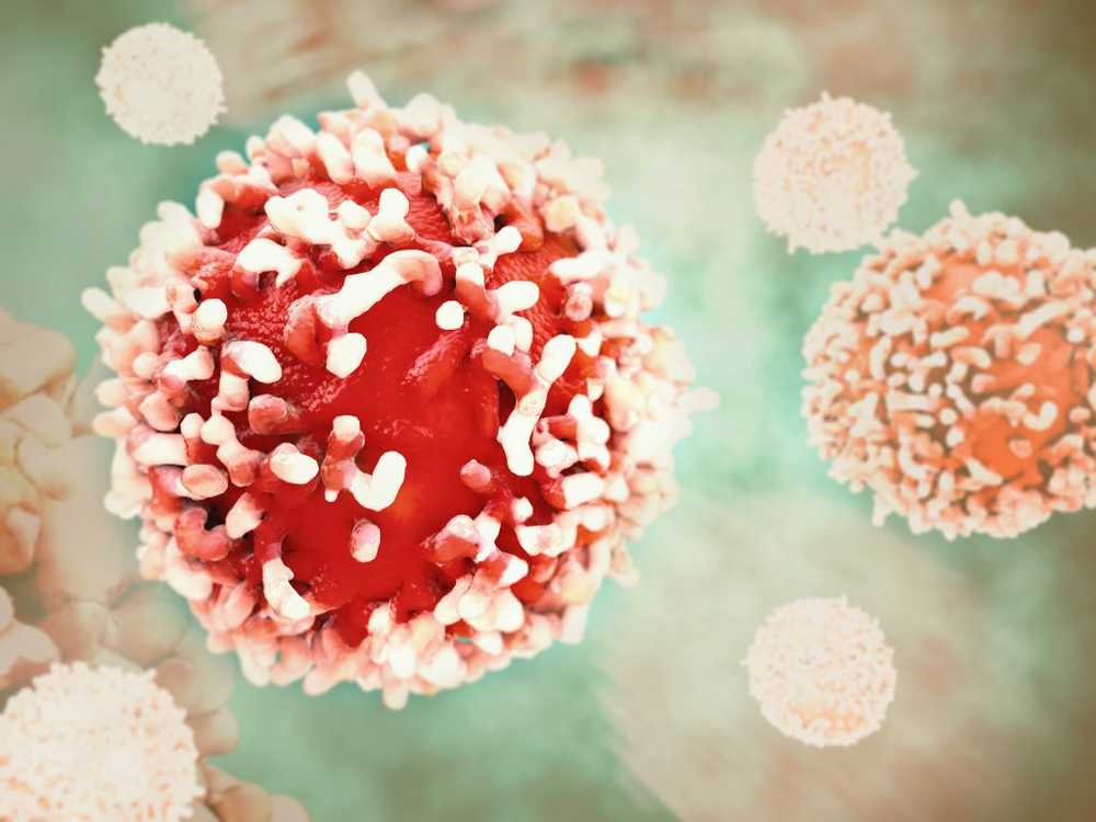 Promising immunotherapy Treat cancer with the body's own antibodies / Health News