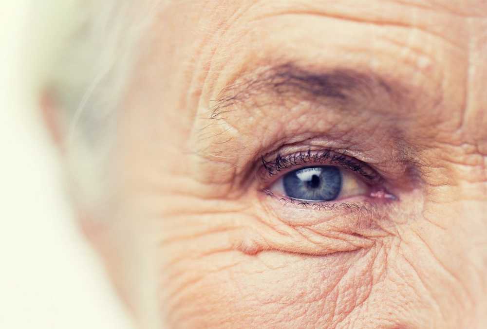 Wrinkles - development, prevention and home remedies