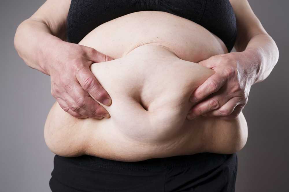 Le coppie obese hanno meno possibilità di rimanere incinta / Notizie di salute