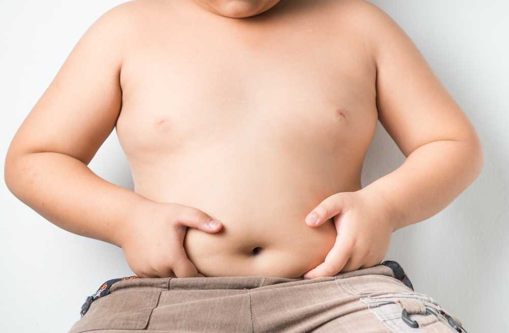 Obesity in children has increased tenfold in the last 40 years / Health News