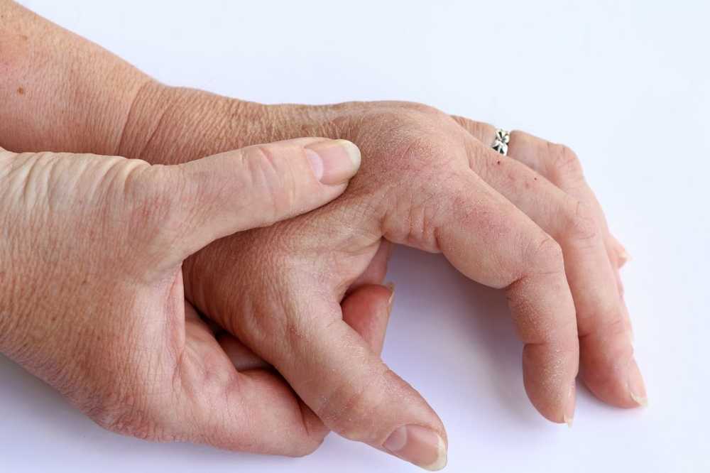 Inflamație articulară pe picior lângă degetul mic - Umflarea durerii articulare a degetului mare