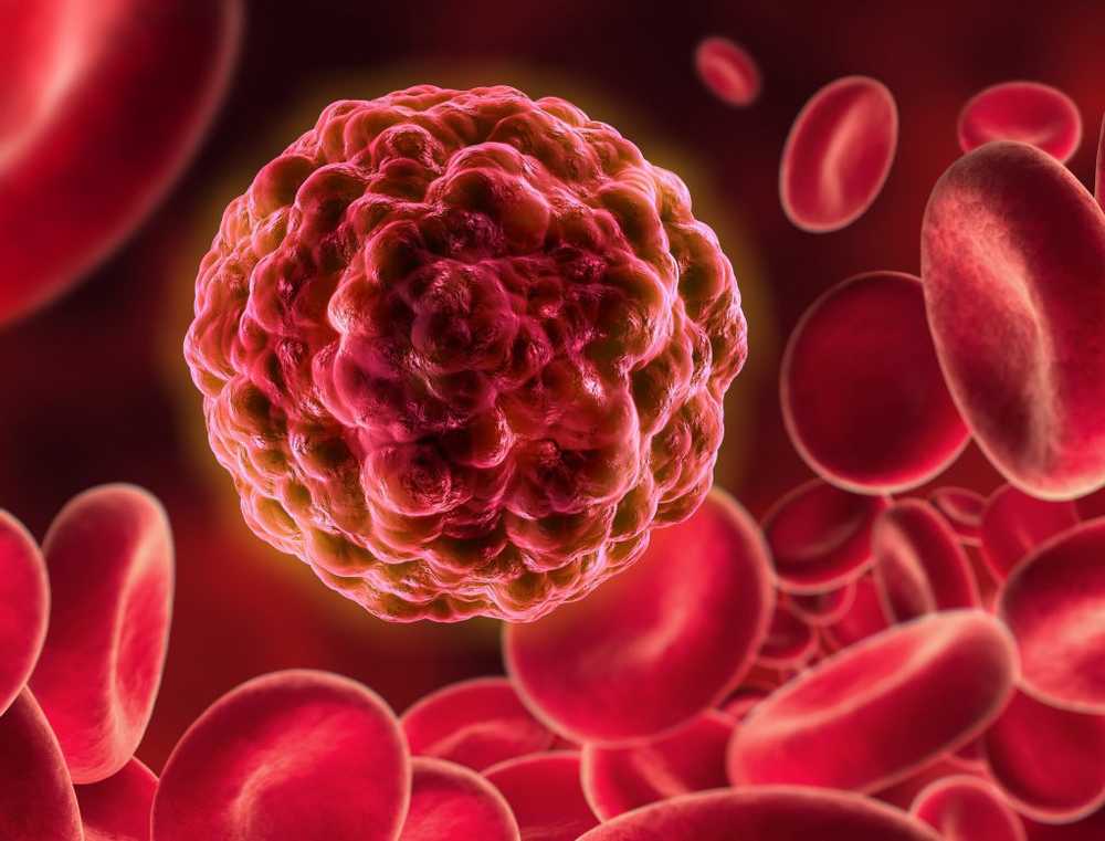 Researchers revolutionize the treatment of leukemia