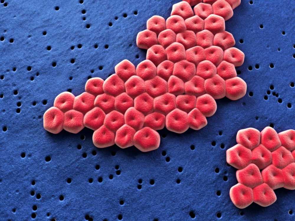 Gezondheidskipavlees vaak besmet met Campylobacter-bacteriën / Gezondheid nieuws