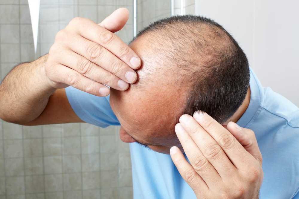 Hair loss This remedy causes hair to sprout again within a few days / Health News