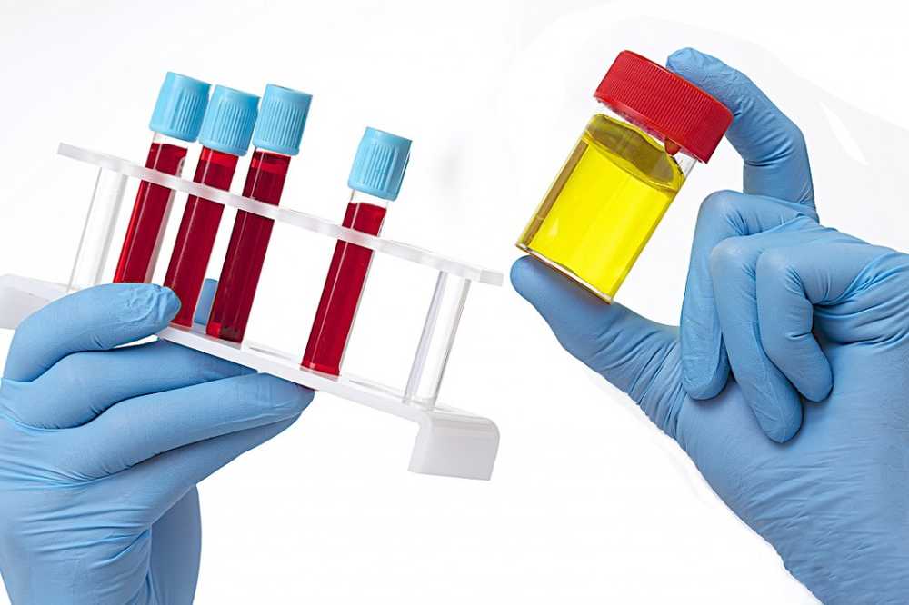 Harmless or a serious illness? The five most common causes of blood in the urine / Health News