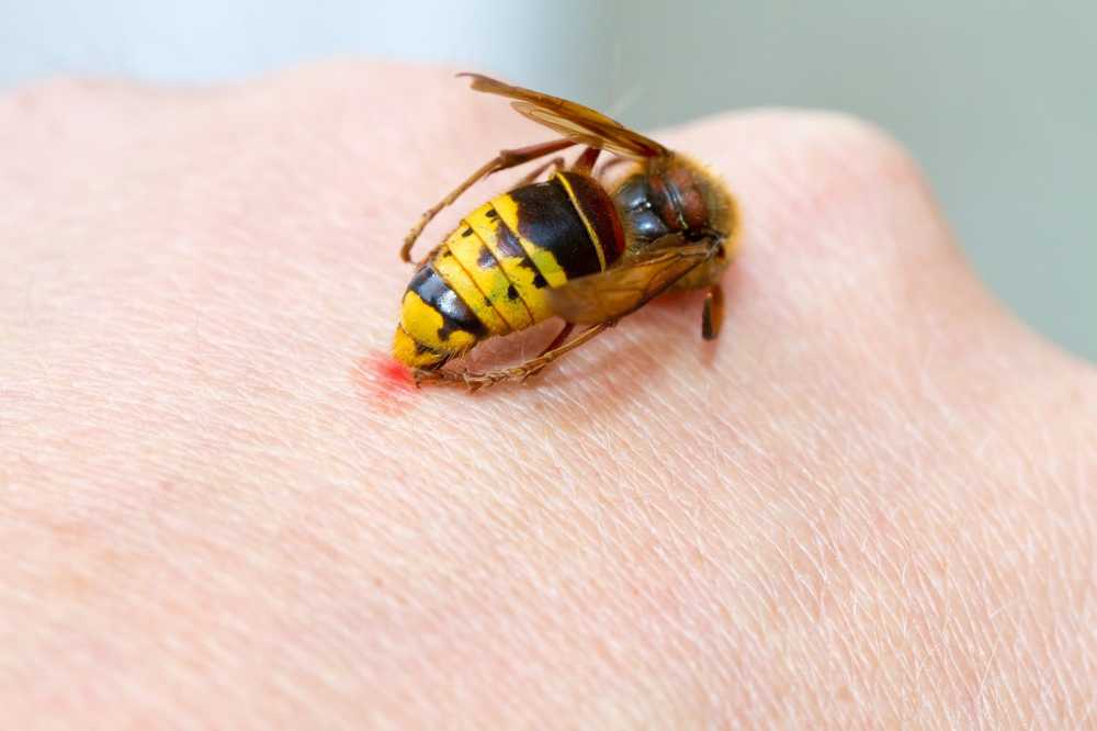 Home remedies for wasp stings / 