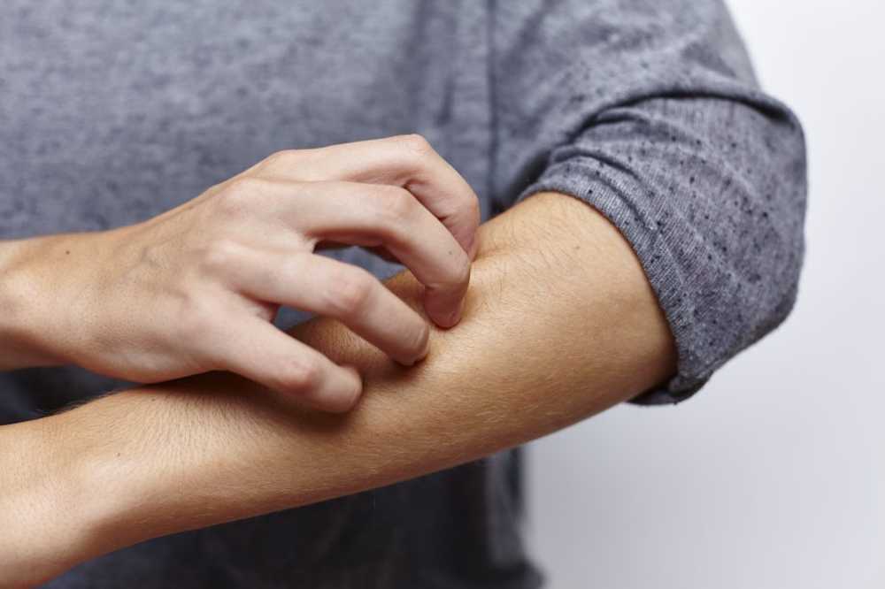 Skin burning and itching Can it be scabies? / Health News