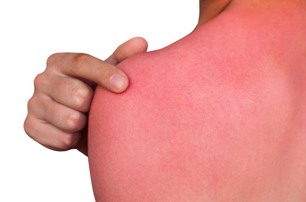 Skin burning - causes and treatment