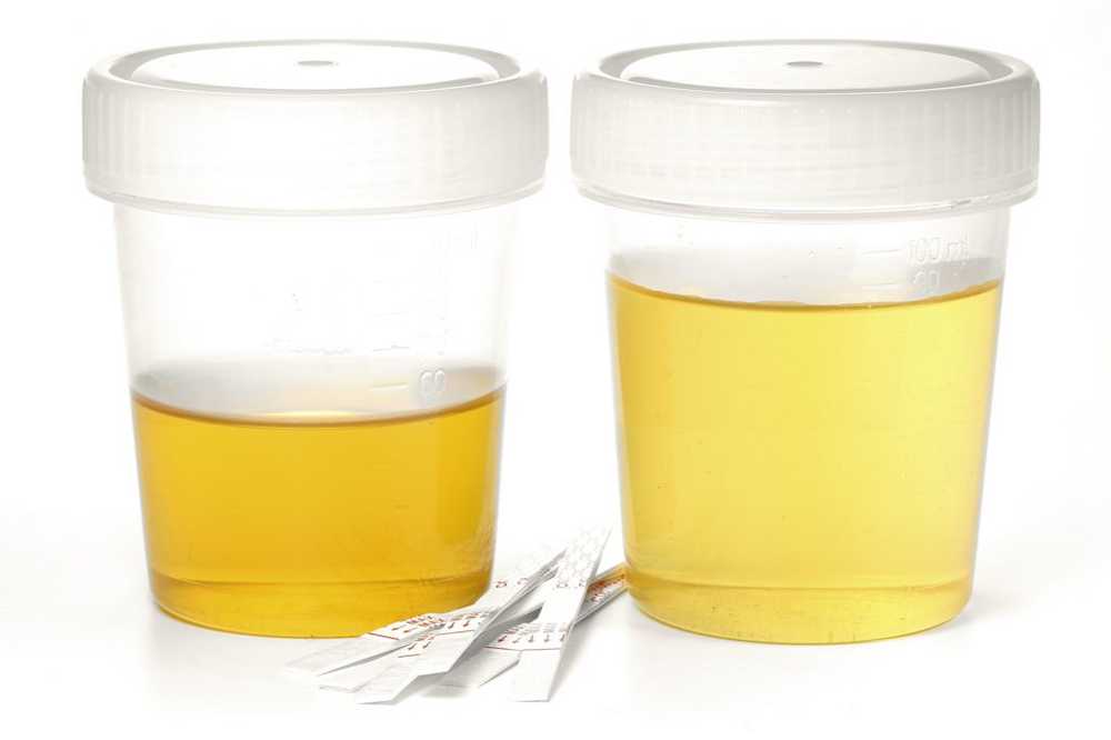 Bright urine - causes, symptoms and therapy