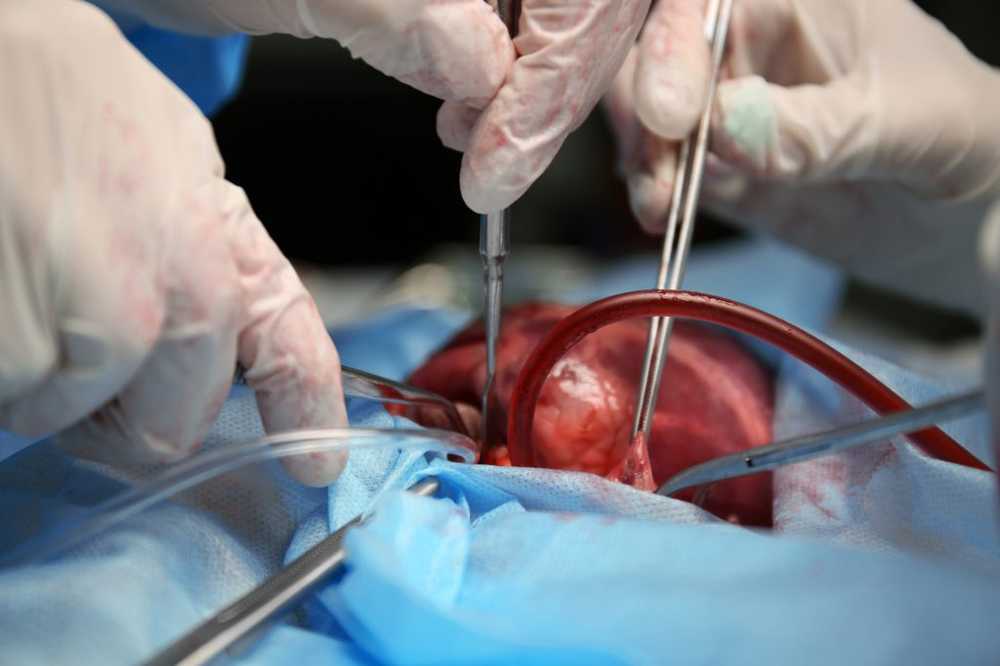 Donate heart Heart surgeons want to donate their own hearts / Health News