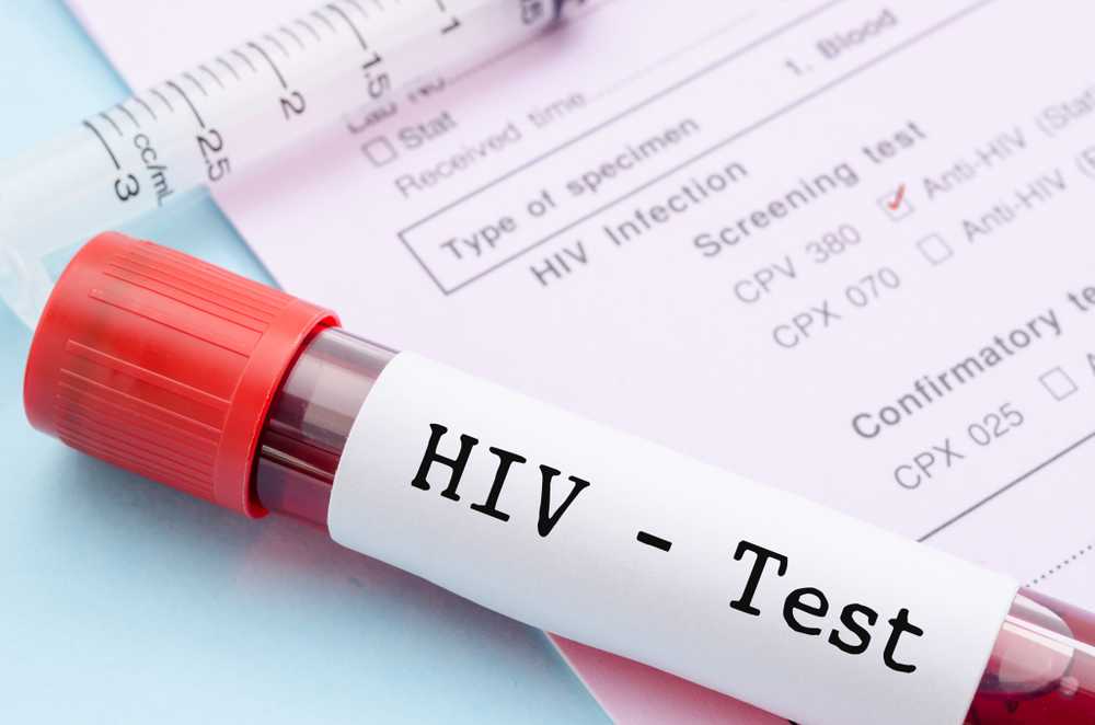 HIV Varje sekund känner inte till sin egen sjukdom / Hälsa nyheter