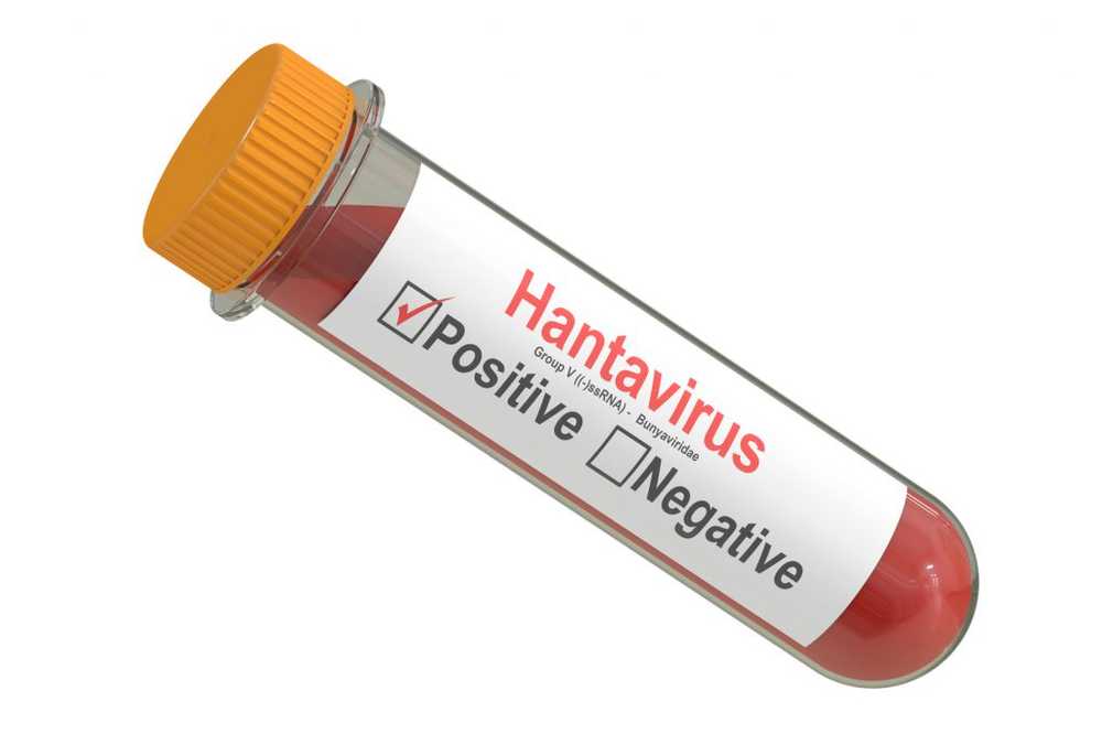 Infections with hantavirus health hazard from the home garage / Health News