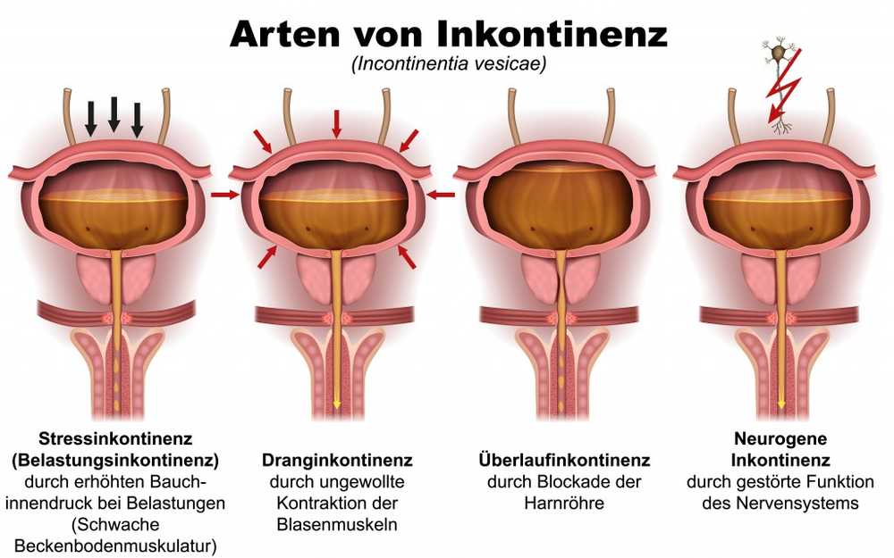 Entretien Quand devriez-vous devenir urologue? / Nouvelles sur la santé