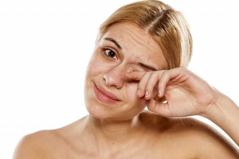 Itchy Eyes - Eye Itching Causes, treatment and home remedies / symptoms