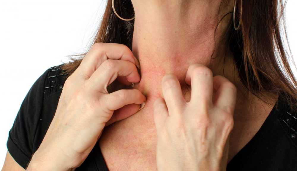 Itchy skin disease scabies returned - these are the symptoms / Health News