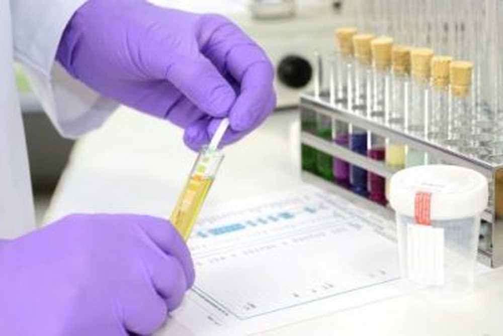 No blood test Cancer diagnosis based on urine? / Health News