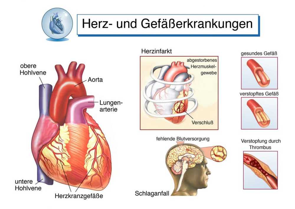 Free guide for patients with artificial heart and cardiac support systems / Health News