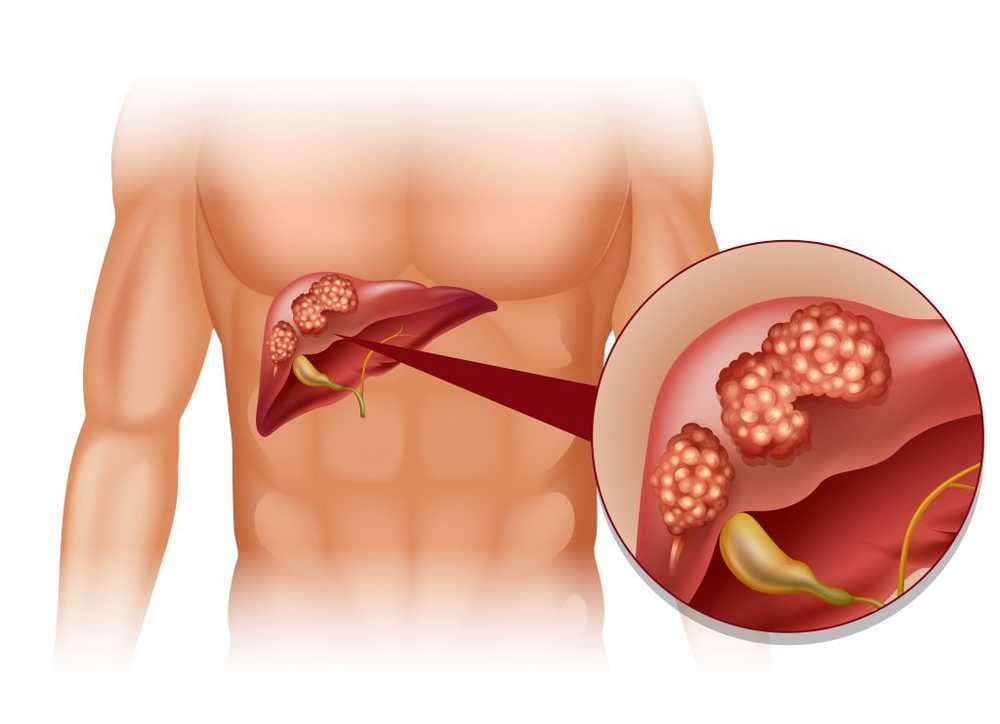 Ricercatori sul cancro Scoperti proteine ​​anticancro non riconosciute / Notizie di salute