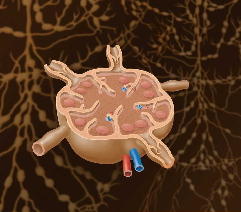 Swollen lymph nodes - swollen lymph nodes