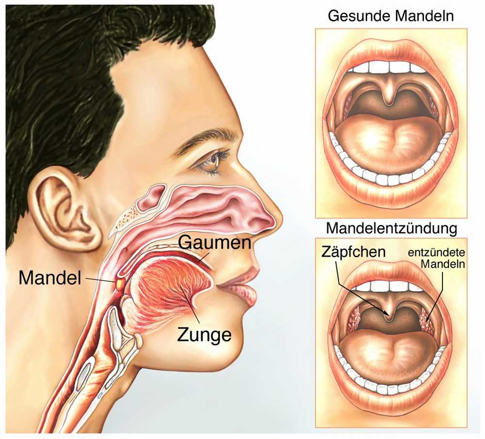 L'élimination des amandes augmente le risque de maladies infectieuses et d'allergies / Nouvelles sur la santé