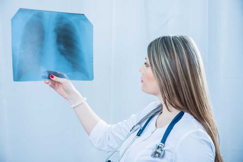 Medical Study Lung cancer screening in smokers can save lives / Health News