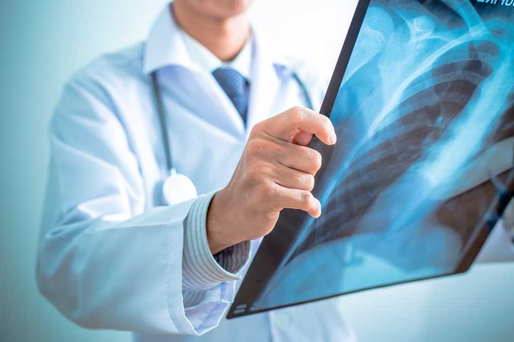 Men in southwestern Germany suffer less often from lung cancer / Health News