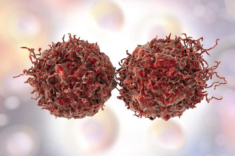 New study Prostate Cancer Therapy Successful in Trial