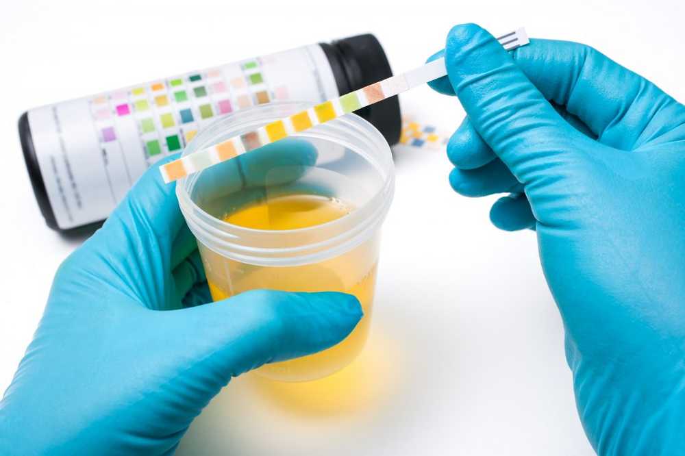 New urine test to check the diet and the subsequent health effects / Health News