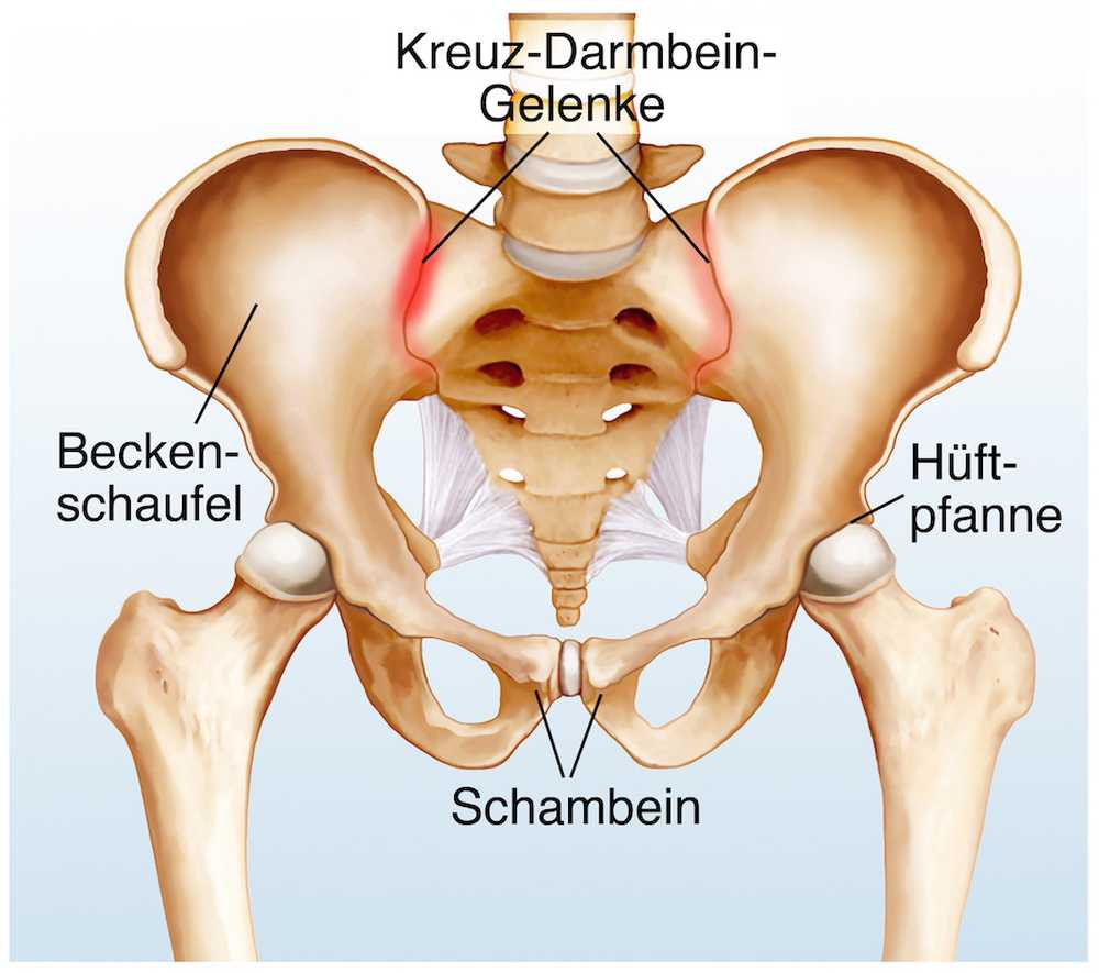 Ofta missförstått smärta orsakar ryggsmärta genom sacroiliac joint / Hälsa nyheter