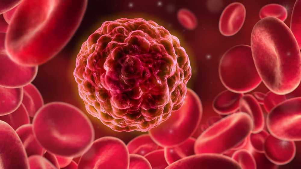 Diagnóstico revolucionario del cáncer La prueba de sangre detecta todas las enfermedades de cáncer en unos pocos minutos / Noticias de salud