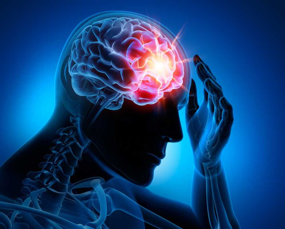 Accident vascular cerebral - Terapia nouă activează tracturile nervoase neutilizate / Știri despre sănătate
